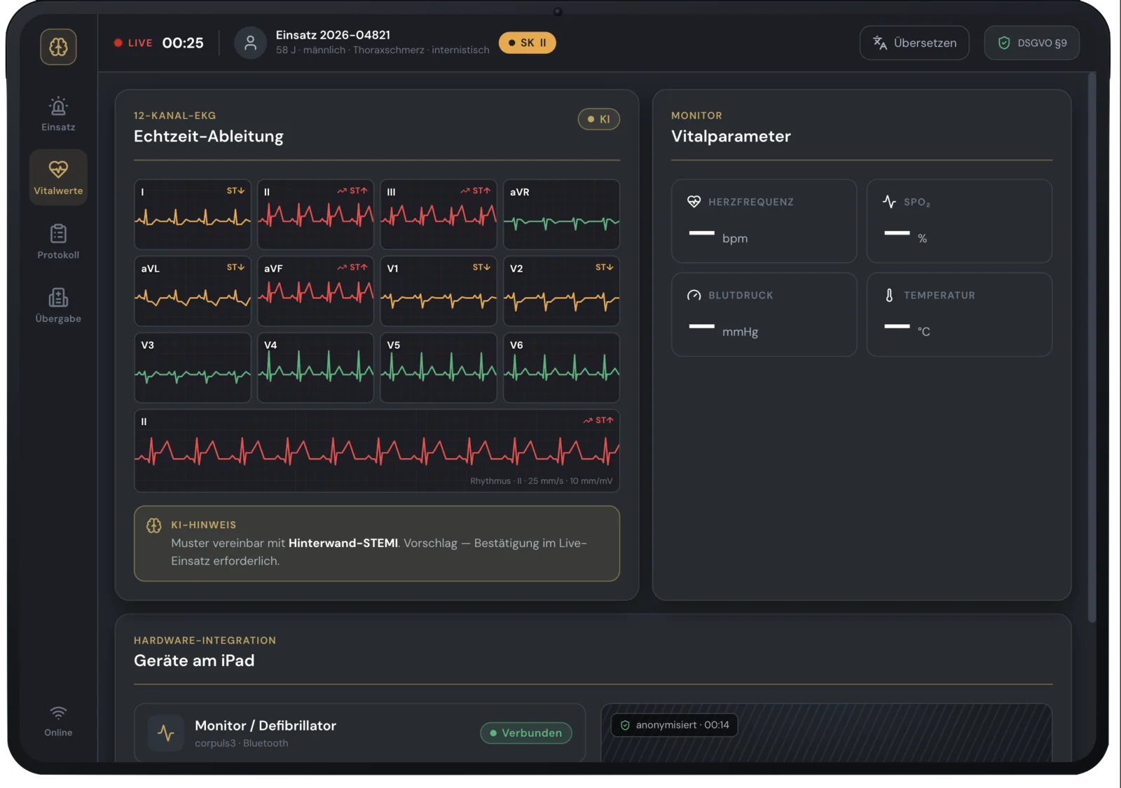 AESKONdocs AI 12-lead ECG grid with vital parameters and an AI hint for a posterior-wall STEMI; device integration marked as target architecture.